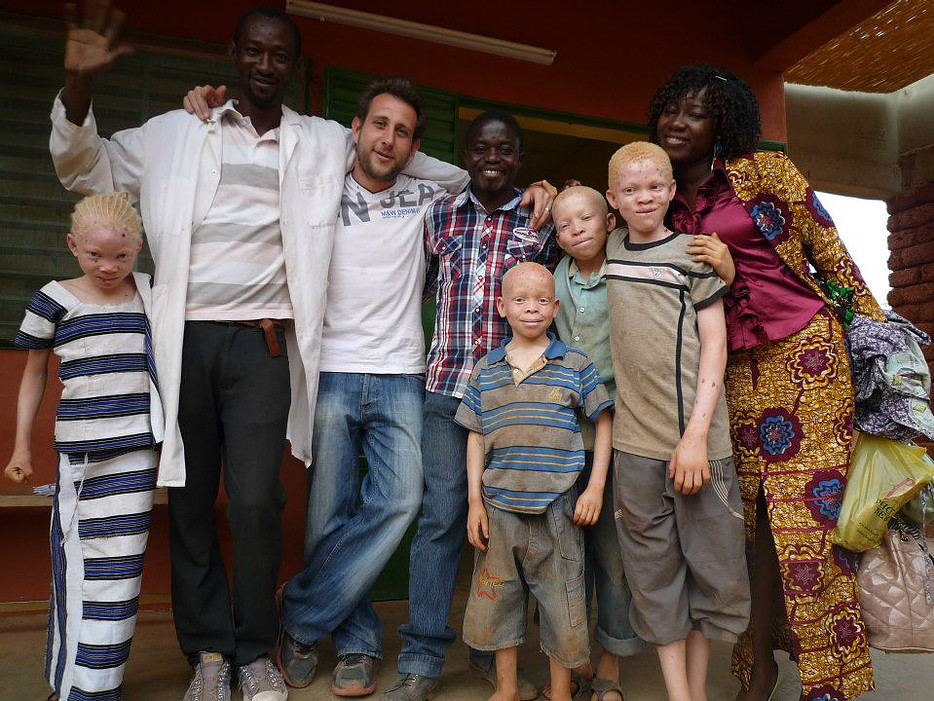 Court métrage Naître albinos